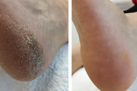 Prej potem za spletno stran 640 640 px